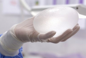 Le Canada interdit à son tour les implants mammaires Biocell d'Allergan