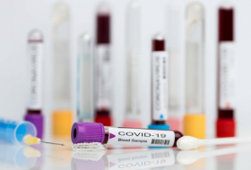  Covid-19: La vaccination commencera en Azerbaïdjan la semaine prochaine 