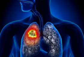 Ce gaz inodore dans votre maison qui augmente le risque de cancer du poumon VIDEO