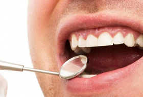 Santé: une dent en 3D pour éliminer les caries