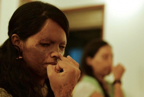 Inde: victime d’une attaque à l’acide, elle est devenue mannequin