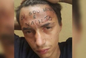 Brésil: Ils lui tatouent de force sur le front «Je suis un voleur»