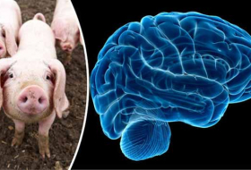 Des chercheurs ont maintenu en vie des cerveaux de cochons sans corps