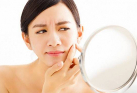 3 choses à éviter quand on souffre d'acné