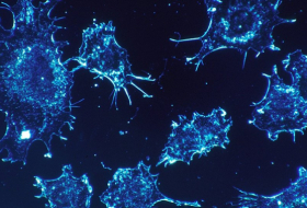 Des scientifiques nomment les sept principaux symptômes du cancer