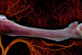 De nouveaux vaisseaux sanguins découverts dans les os