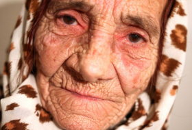  Cette grand-mère soigne ses patients en leur léchant les yeux 