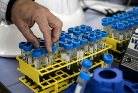 Coronavirus: lancement en France d'un test avec du plasma de patients guéris