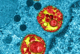   Coronavirus:  l'image rare d'une cellule respiratoire infectée 