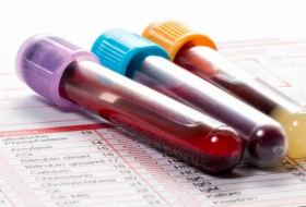 Un test sanguin révolutionnaire dans la détection des cancers?