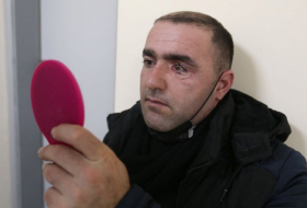  Un vétéran azerbaïdjanais reçoit une prothèse oculaire importée d'Israël 