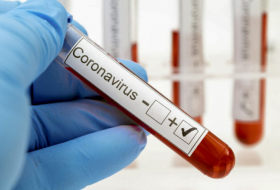  Coronavirus: 3 714 nouvelles contaminations enregistrées en une journée en Azerbaïdjan 