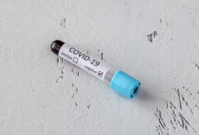 Coronavirus: 3 069 nouveaux cas confirmés en une journée en Azerbaïdjan