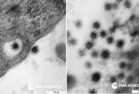 Une image rare de la souche Delta du coronavirus a été publiée