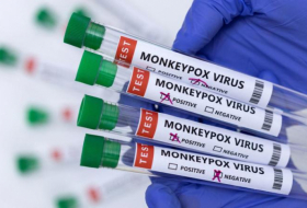 Variole du singe: en France, la Haute autorité de santé recommande de vacciner les cas contacts