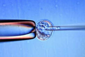 Des chercheurs modifient des gènes d'un embryon humain, une première aux Etats-Unis
