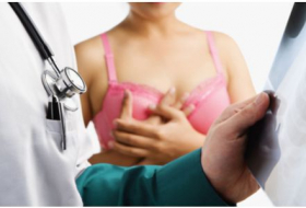 Aux Etats-Unis, le nombre de double mastectomie a triplé en 10 ans